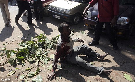 An injured man calls for help after being injured by a bomb